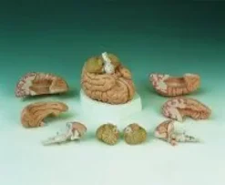 Cervello in 8 parti