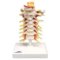 Colonna vertebrale cervicale
