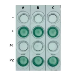 Kit AIDS I: Simulazione del Rilevamento dell'HIV mediante ELISA