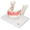 Patologie dentali, ingrandito 2 volte, 21 pezzi