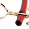 Pinza in Ottone Nichelato di Mohr 80 mm